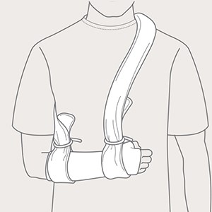 Step 4 of arm support with Collar'n'Cuff