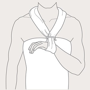 Step 2 of arm and shoulder immobilisation with Collar'n'Cuff